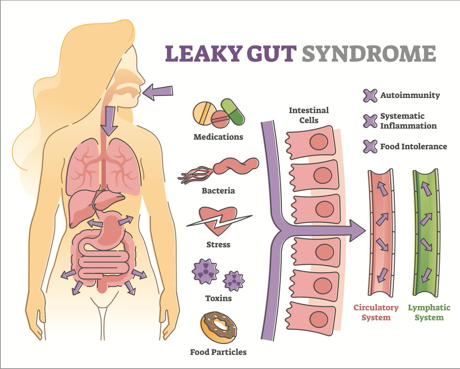 What is Leaky Gut?